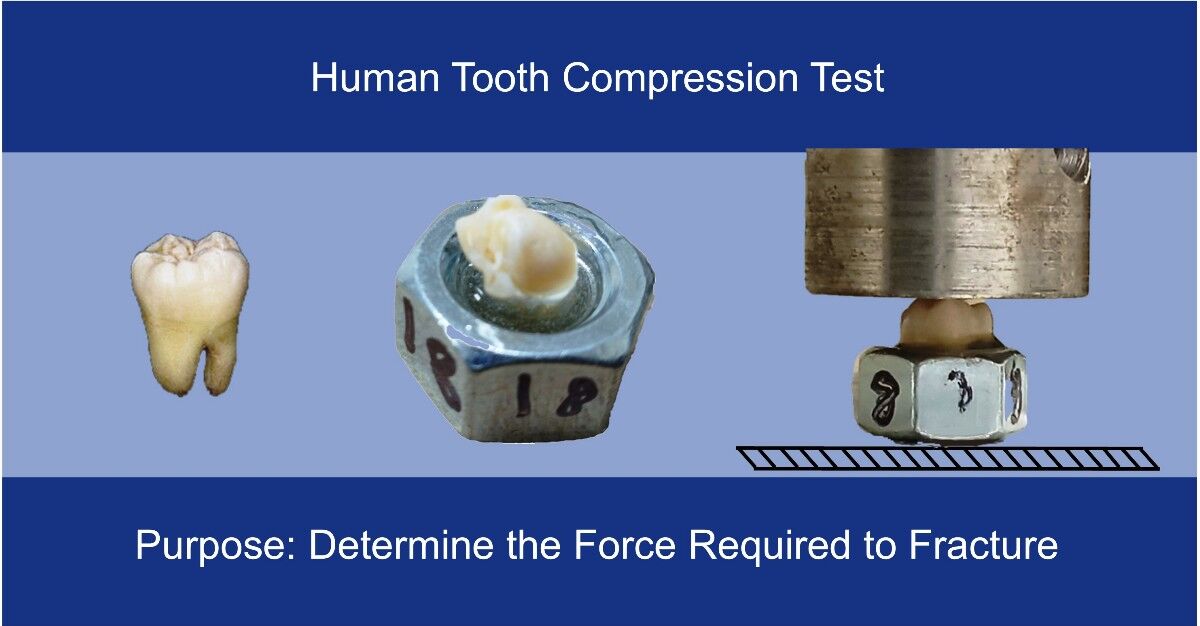 ASU Senior Thesis: Human Tooth Compression Test